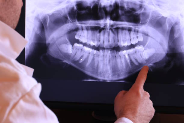 Best Emergency TMJ Treatment in Sherwood, OH