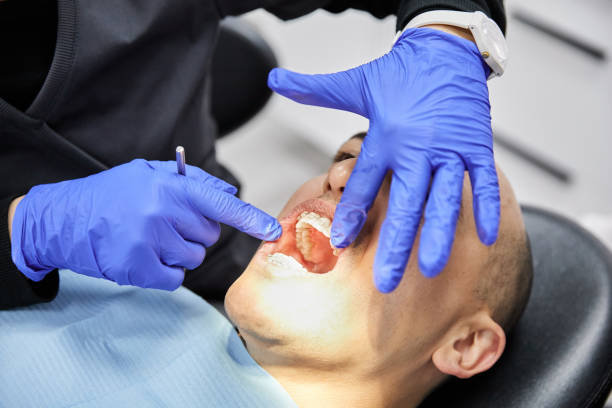 Best Urgent Care for Lost Fillings or Crowns in Sherwood, OH